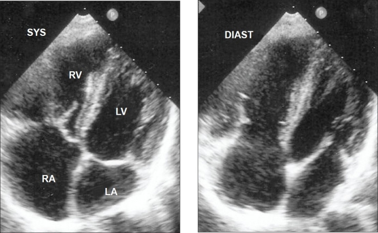 Fig 4