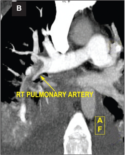 Fig 3B