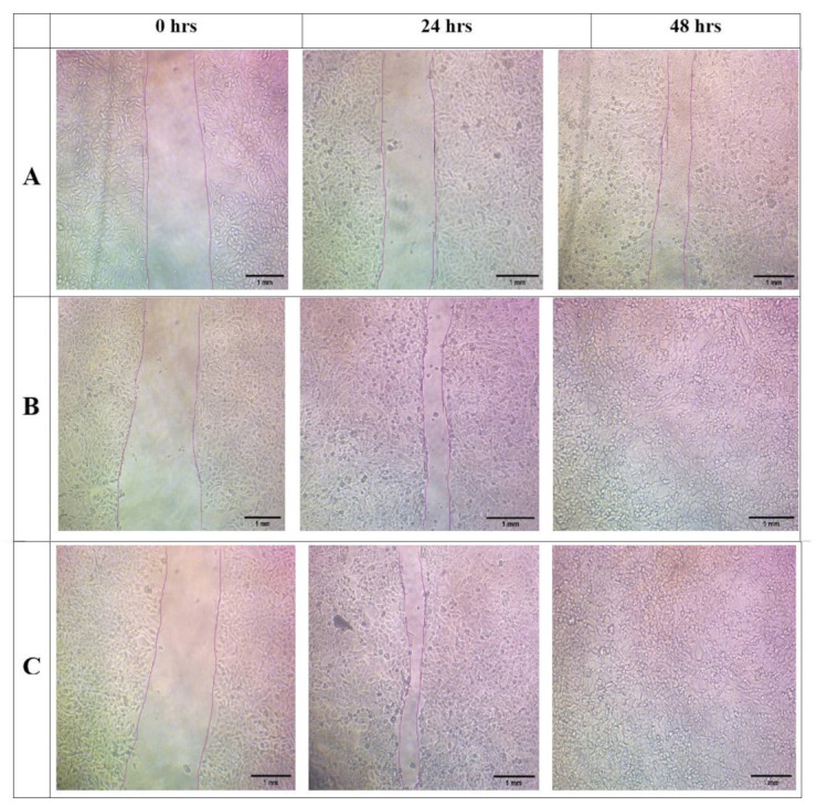 Figure 11