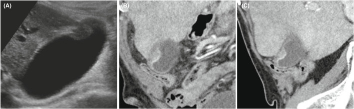 FIGURE 3