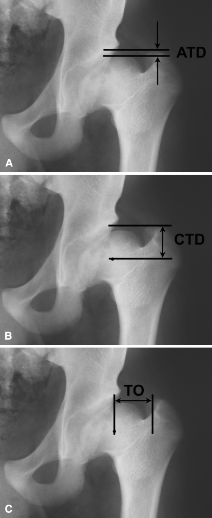 Fig. 2A–C