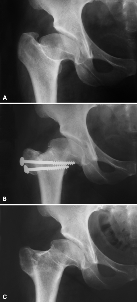 Fig. 3A–C