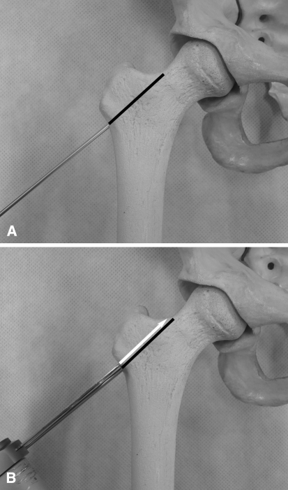 Fig. 1A–B