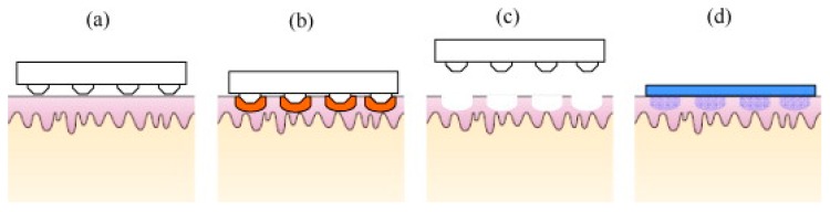 Figure 12