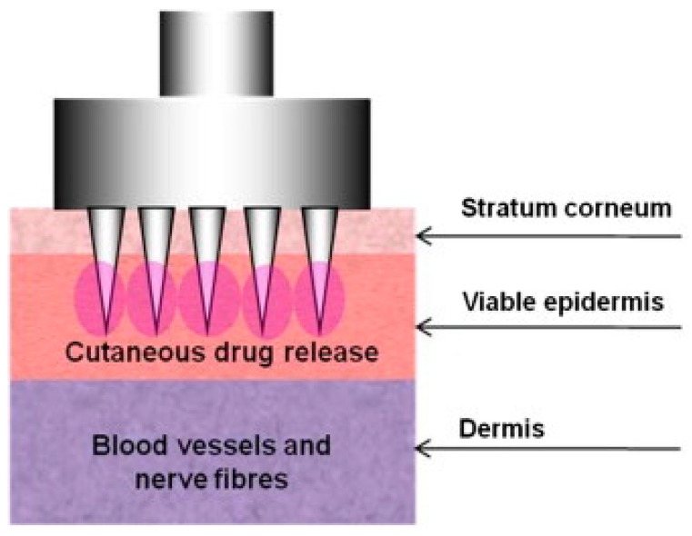 Figure 13