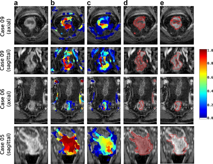 Fig. 16