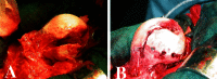 Fig. 1A–B