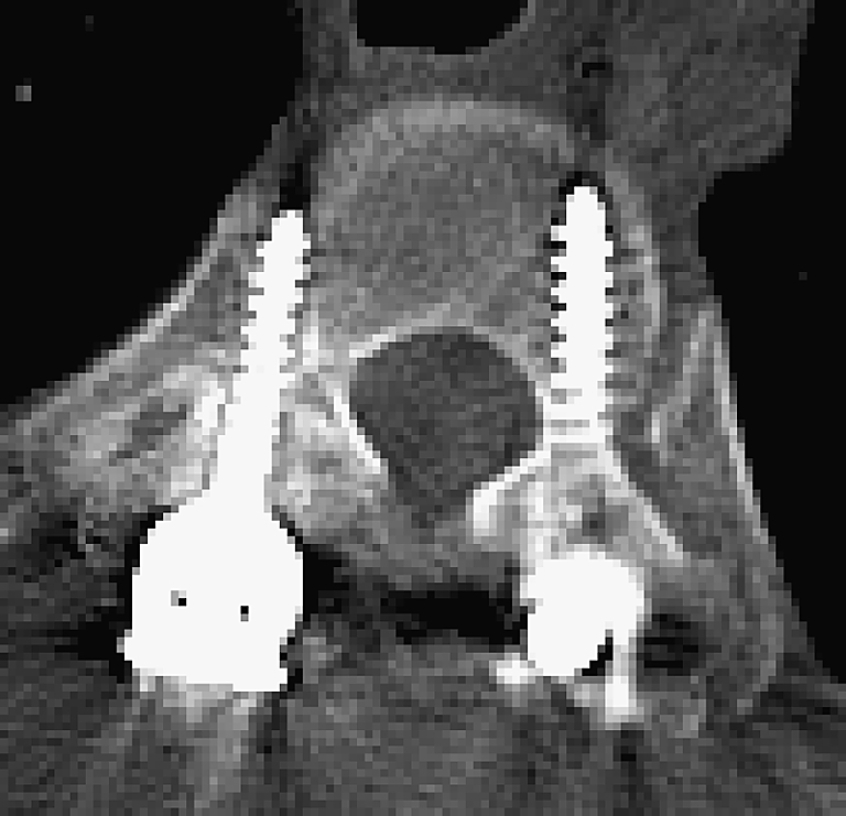 Fig. 3