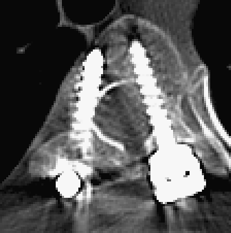 Fig. 2