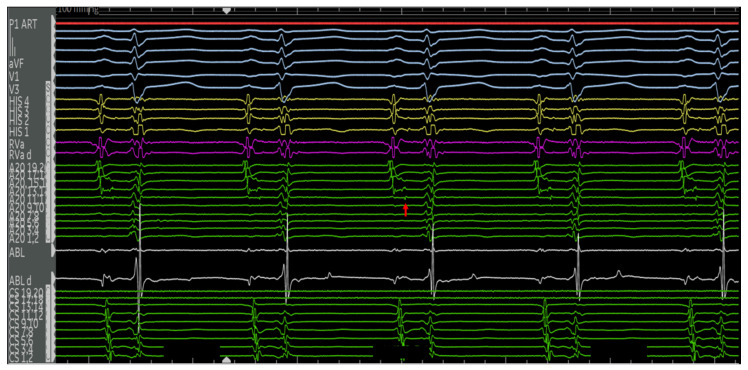 Figure 5