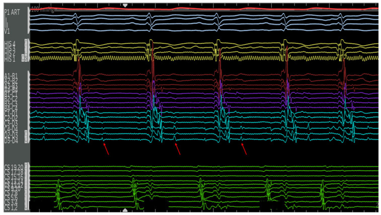 Figure 12