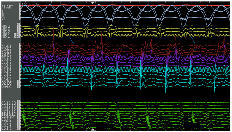 Figure 13