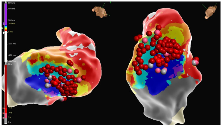 Figure 15