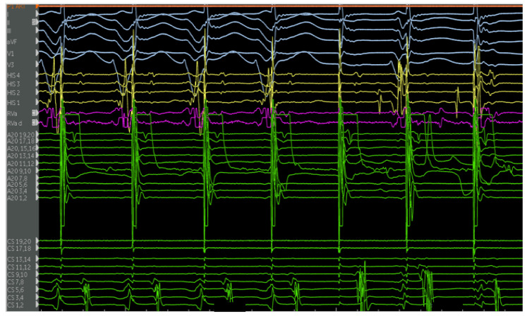 Figure 7