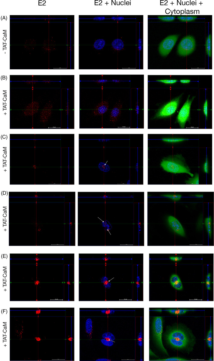 FIGURE 2