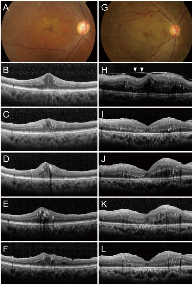 Fig. 2