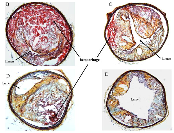 Fig. 10