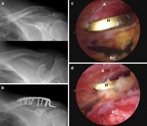 Fig. 2