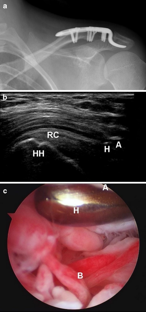 Fig. 4