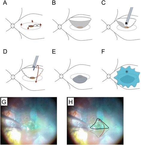 Fig. 2