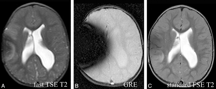 Fig 5.