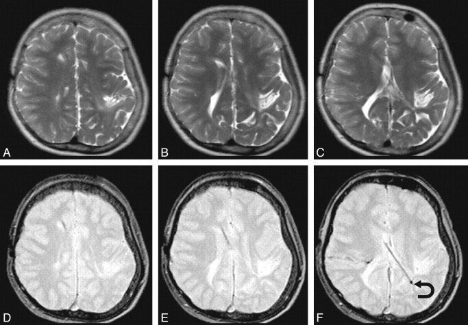 Fig 2.