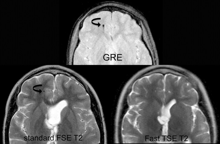 Fig 3.