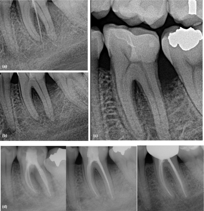 FIGURE 11