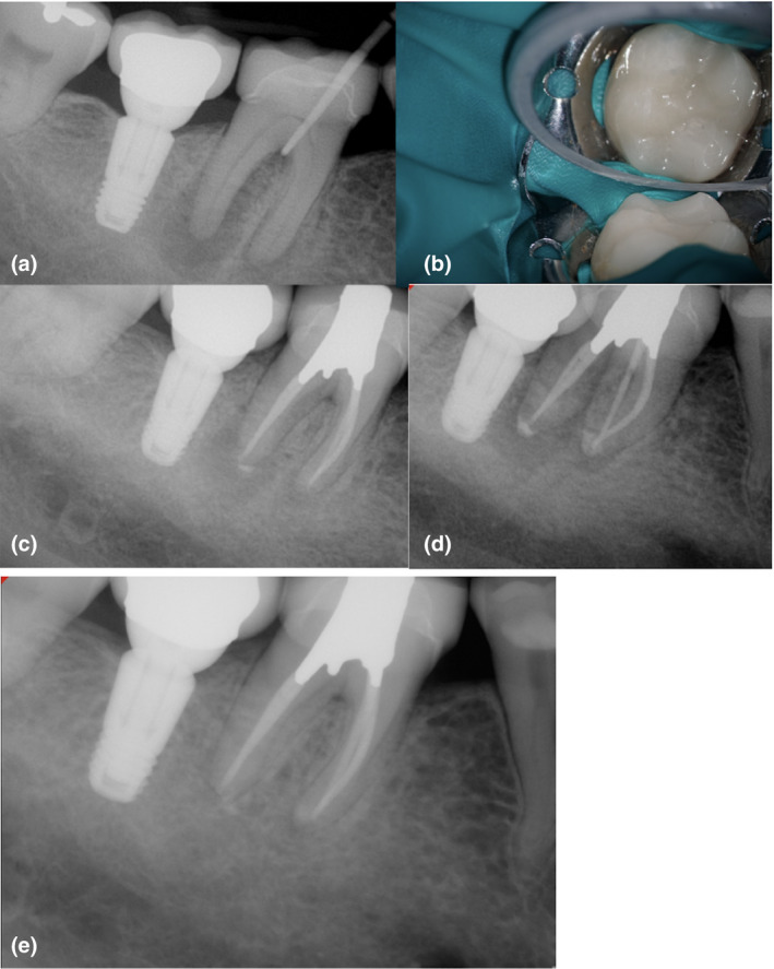 FIGURE 12