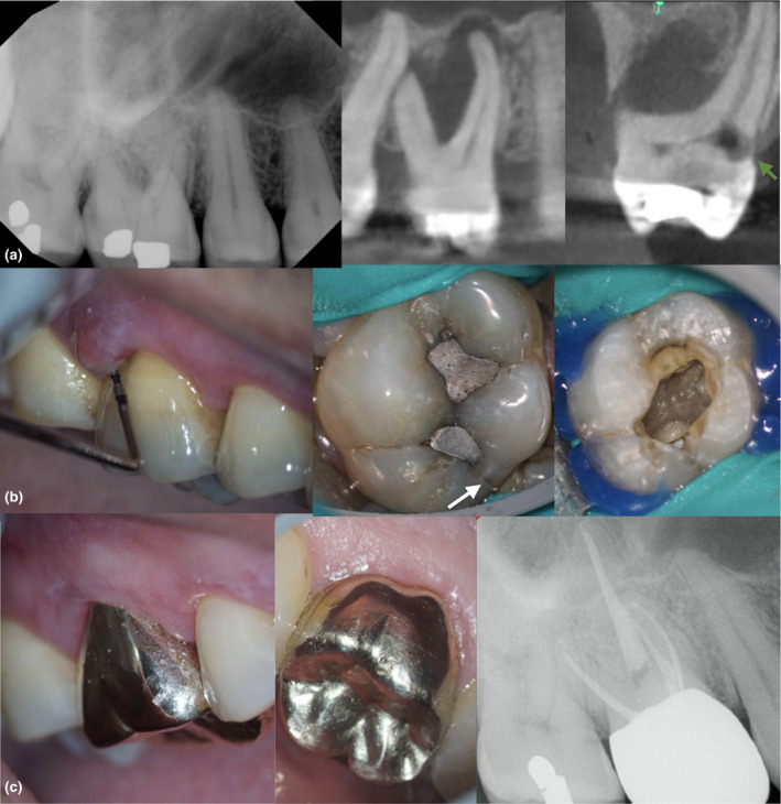 FIGURE 14