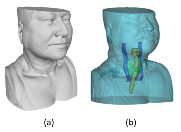 Figure 17