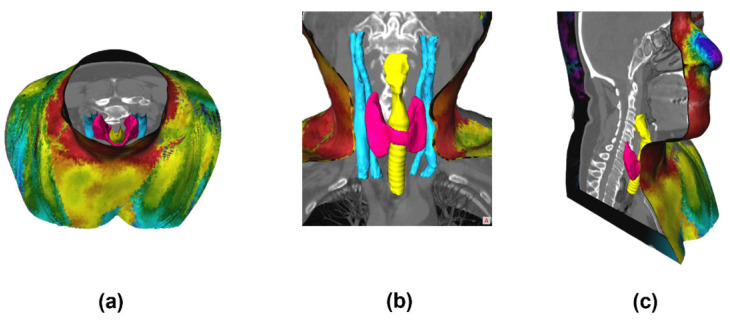 Figure 20