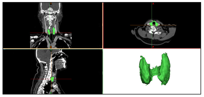 Figure 14