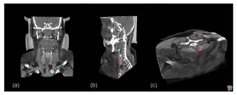 Figure 18