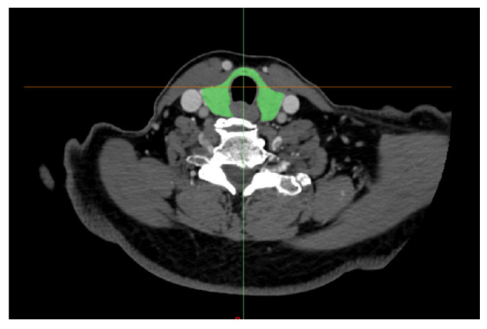 Figure 15