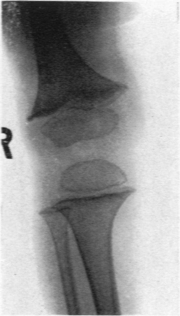 Fig. 18