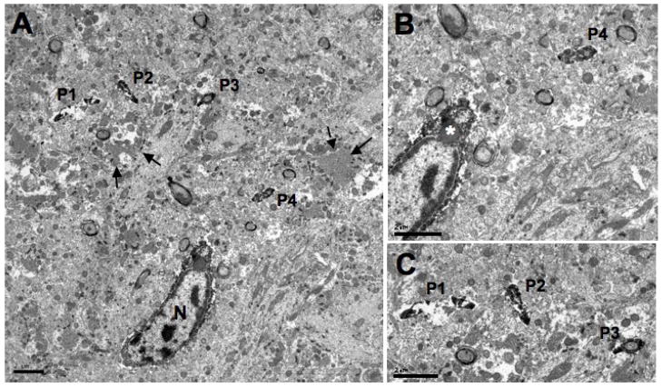 Morphological and ultrastructural features of Iba1-immunolabeled ...