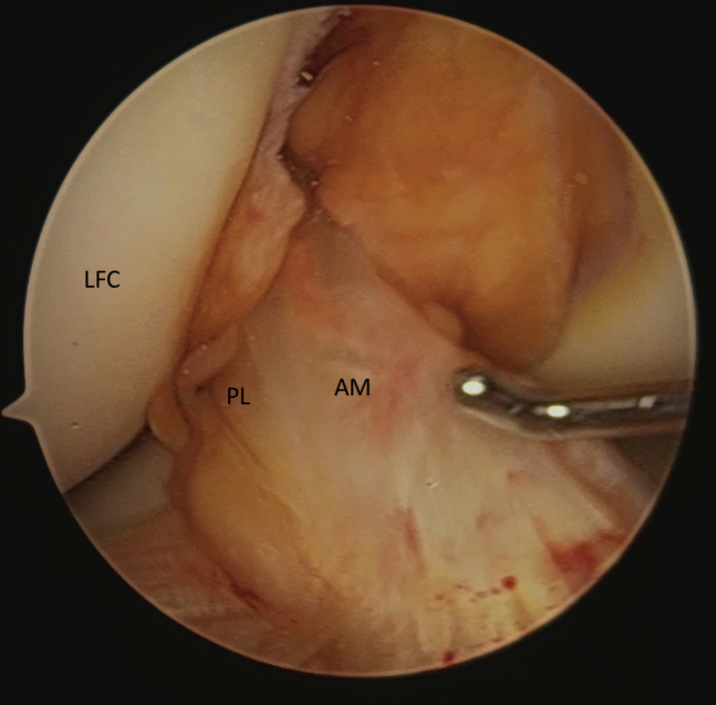 Fig. 1