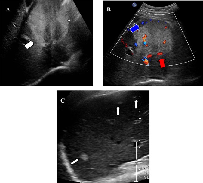 Figure 1