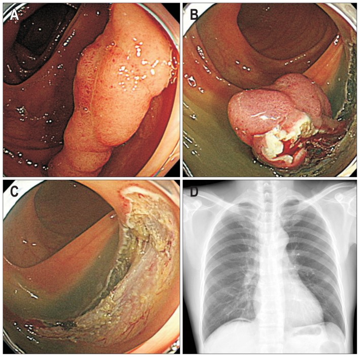 Fig. 3