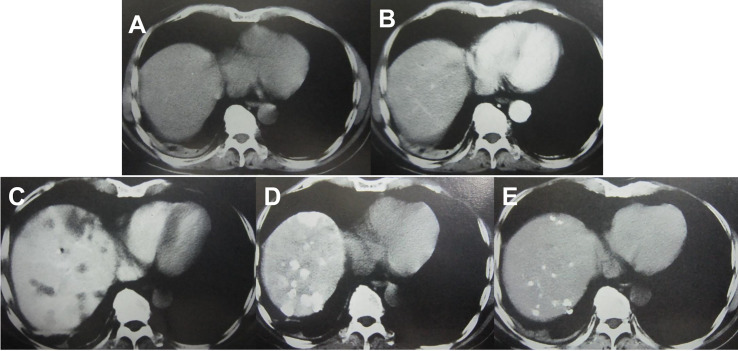 Figure 3