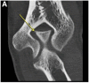 Figure 11.