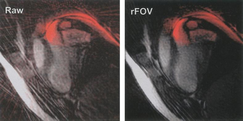 FIG. 6