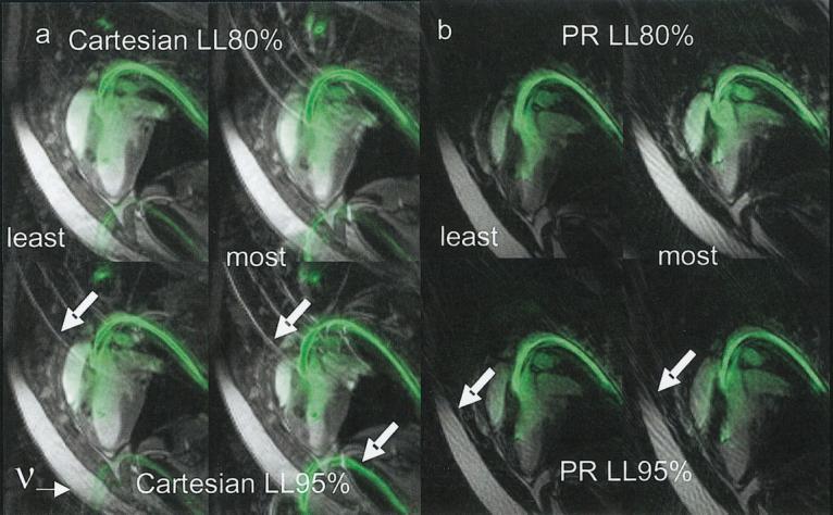 FIG. 7