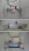 Fig. 1