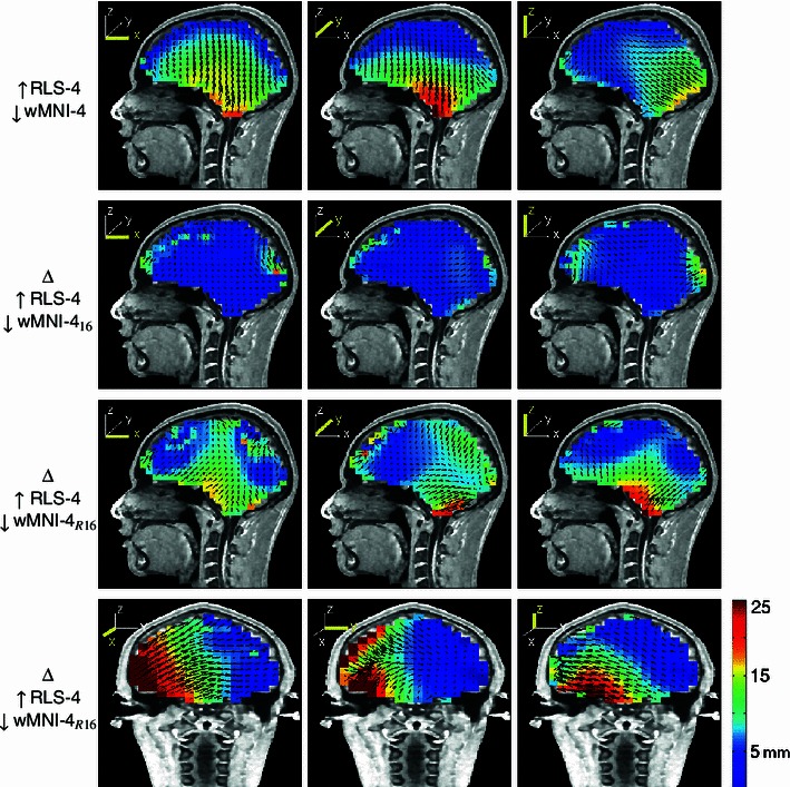 Fig. 15