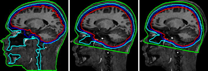 Fig. 3