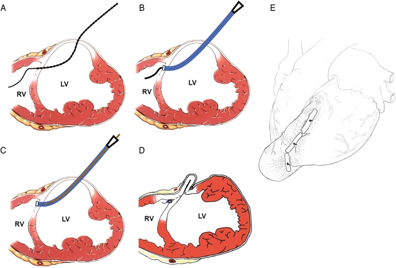 Figure 1: