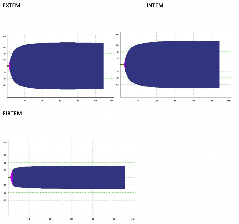 Fig. 1