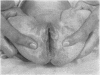 44